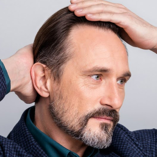 prp treatment | hair restoration