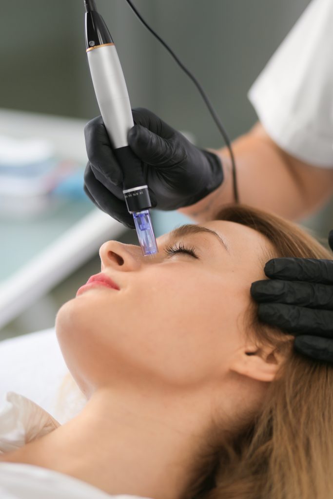 prp microneedling in texas