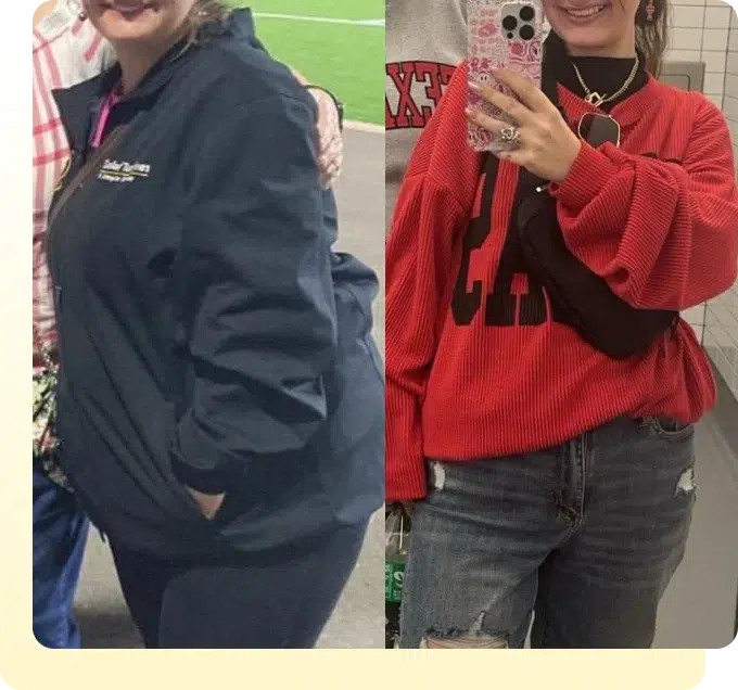 Retatrutide weight loss result