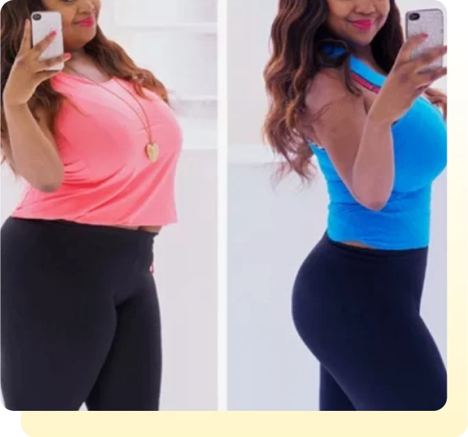 Retatrutide weightloss